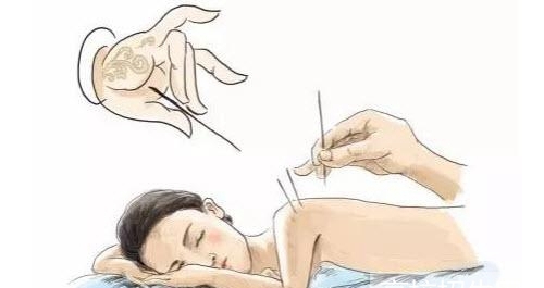 贵州省学针灸推拿专业哪个学校好